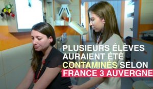 Epidémie de gale : un lycée obligé de fermer dans le Puy-de-Dôme