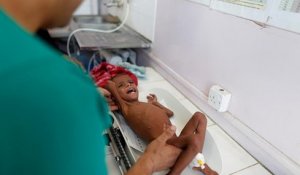 Malnutrition : le Yémen "au bord du précipice" (ONU)