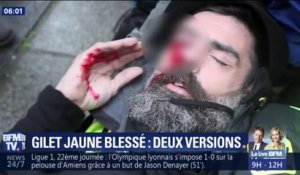 Gilets jaunes: les deux versions qui s'opposent sur la blessure à l’œil de Jérôme Rodrigues