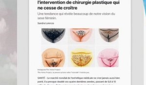 Chirurgie esthétique : la nouvelle mode du rajeunissement vaginal