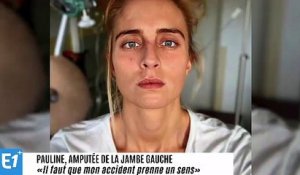 Pauline, amputée de la jambe gauche : "Il faut que mon accident prenne un sens"