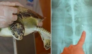 Cette tortue, repêchée au large de Buenos Aires, a déféqué des dizaines de déchets plastiques en un mois