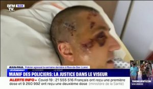 "Si rien n'est fait, ce sera un autre policier ou un citoyen à ma place ": le policier agressé à Rive-de-Gier témoigne