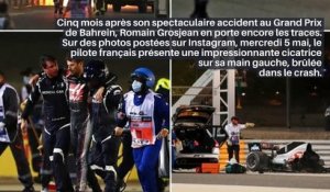 Romain Grosjean : cinq mois après son spectaculaire accident, il dévoile les cicatrices de ses brûlures_IN