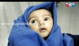 Public TV Digital | Mangaluru Baby Discharged After Successful Heart Surgery