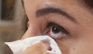 Santé - Le traitement des yeux et des paupières irrités