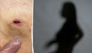 «J'ai des trous dans le corps» : une victime d’injections illégales dans les fesses raconte son calvaire