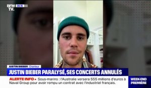 "Paralysé d'une partie du visage", Justin Bieber annule la suite de sa tournée mondiale