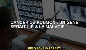 Cancer du poumon: un gène serait lié à la maladie