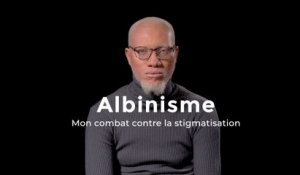 Mon combat contre la stigmatisation des albinos