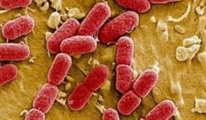 E.coli : la société britannique mise en cause conteste...