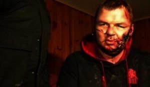 Ukraine: l'opposant torturé Dmytro Boulatov raconte son calvaire - 01/01