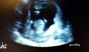 Ce Bebe Pose Fierement Sur L Echographie De Sa Maman Sur Orange Videos