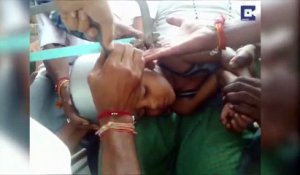 Intervention risquée pour libérer la tête d'un garçon coincée dans une cocotte-minute
