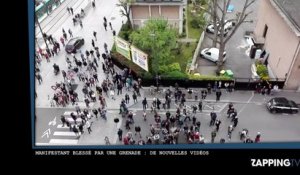 Loi Travail – Manifestant blessé par une grenade : De nouvelles images chocs ! (Vidéo)