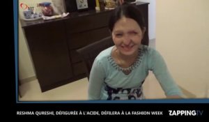 New-York : Défigurée à l'acide, une jeune indienne défilera pour la Fashion Week