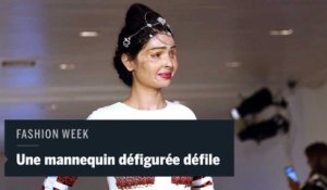 Un mannequin défiguré à l'acide en vedette à la Fashion Week de New York