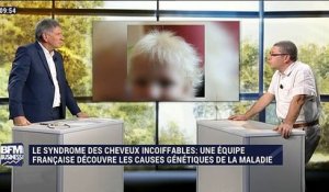 Syndrome des cheveux incoiffables: une équipe française découvre les causes génétiques de la maladie - 17/12