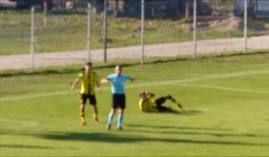 Oh la vilaine blessure : terrible fracture au genou de Dario Scuderi (Borussia Dortmund)