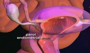 Le syndrome prémenstruel (SPM) expliqué en vidéo