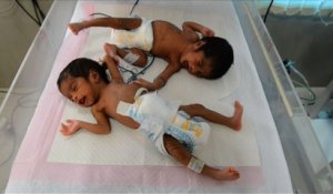 L’Inde a le record mondial du nombre de décès de nouveaux-nés