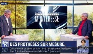 Des prothèses sur mesure