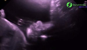 Quand Ton Bebe Est Vraiment Pret A Sortir Du Ventre Un Vrai Petit Monstre A L Interieur Sur Orange Videos