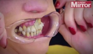 Elle se recolle les dents à la glue pour éviter d'aller chez le dentiste, tellement elle en a peur