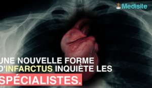 La nouvelle forme d'infarctus de plus en plus répandue