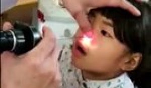 Ce que retire ce medecin du nez d'un enfant est incroyable
