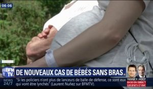 Trois nouveaux cas de bébés sans bras signalés dans les Bouches-du-Rhône