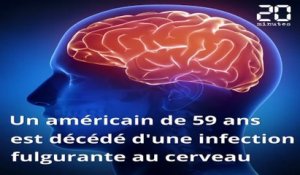 Un Américain tué par une amibe «dévoreuse de cerveau»