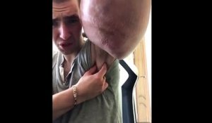 Ce bodybuildeur russe a abusé des injections de Synthol et risque gros