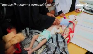 Distribution d'aide alimentaire au Yémen touché par la malnutrition