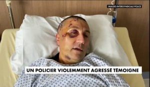 Le témoignage choc d'un policier violemment agressé