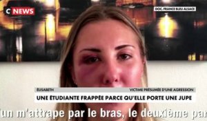 Strasbourg : une étudiante agressée parce qu’elle portait une jupe