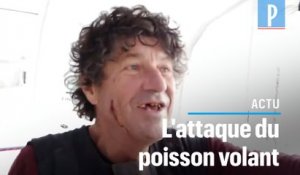 Vendée Globe : Jean Le Cam blessé au visage , percuté par un poisson volant