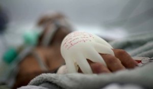Covid-19 au Brésil : «les mains d’amour», ces gants chauds qui réconfortent les patients en soins intensifs