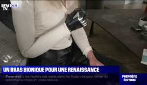La première Française équipée d'un bras bionique témoigne sur BFMTV