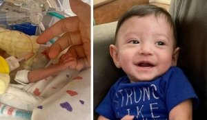 Né à 24 semaines, ce bébé prématuré qui avait peu de chance de survie a fêté son 1er anniversaire