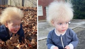 Une mère découvre que son fils est atteint du syndrome des cheveux incoiffables, une maladie rare et méconnue