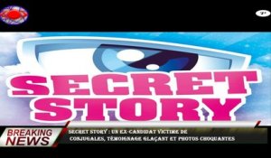 Secret Story : Un ex-candidat victime de  conjugales, témoignage glaçant et photos choquantes