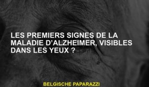 Les premiers signes de la maladie d’Alzheimer, visibles dans les yeux ?