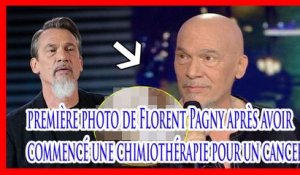 Choqué par la première photo de Florent Pagny après avoir commencé une chimiothérapie pour un cancer