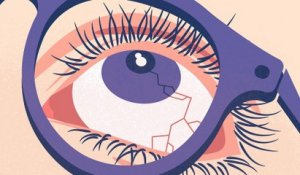 Les secrets pour préserver la santé de vos yeux de façon naturelle.