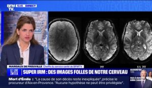 L'IRM "le plus puissant du monde" dévoile des images folles de notre cerveau