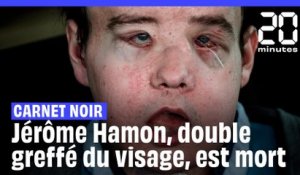 Mort de Jérôme Hamon, l’homme aux deux greffes de visage