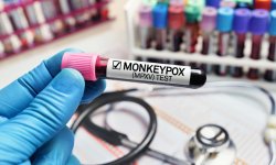 La variole du singe est-elle dangereuse ?