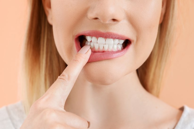 L'érosion de l'émail dentaire est la perte progressive de l'émail, la couche dure qui tapisse nos dents.