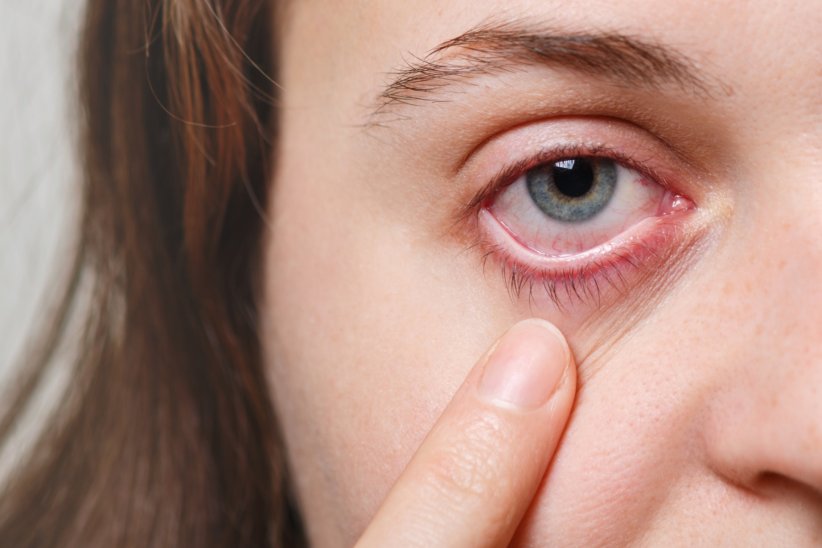 Les yeux rouges peuvent être le signe d'une fatigue oculaire.